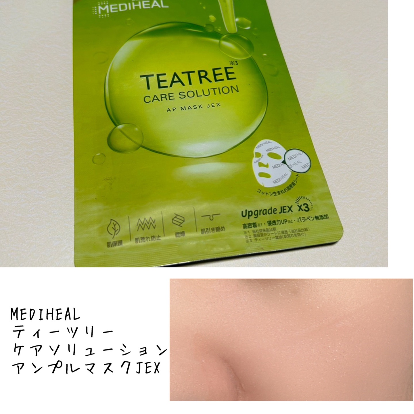 ティーツリーケアソリューション アンプルマスクJEX 25ml×1枚/MEDIHEAL/シートマスク・パックを使ったクチコミ（1枚目）