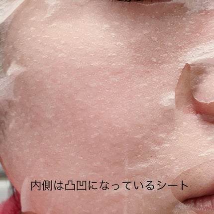 毛穴小町 テカリ源治 マスク/クリアターン/シートマスク・パックを使ったクチコミ(6枚目)