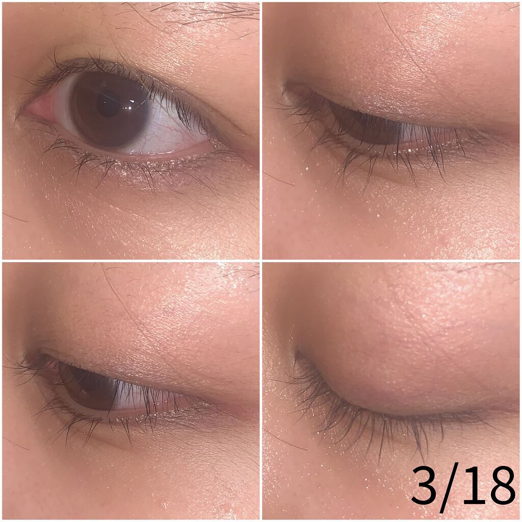 ラッシュアディクト アイラッシュコンディショニングセラム/soaddicted/まつげ美容液を使ったクチコミ（3枚目）