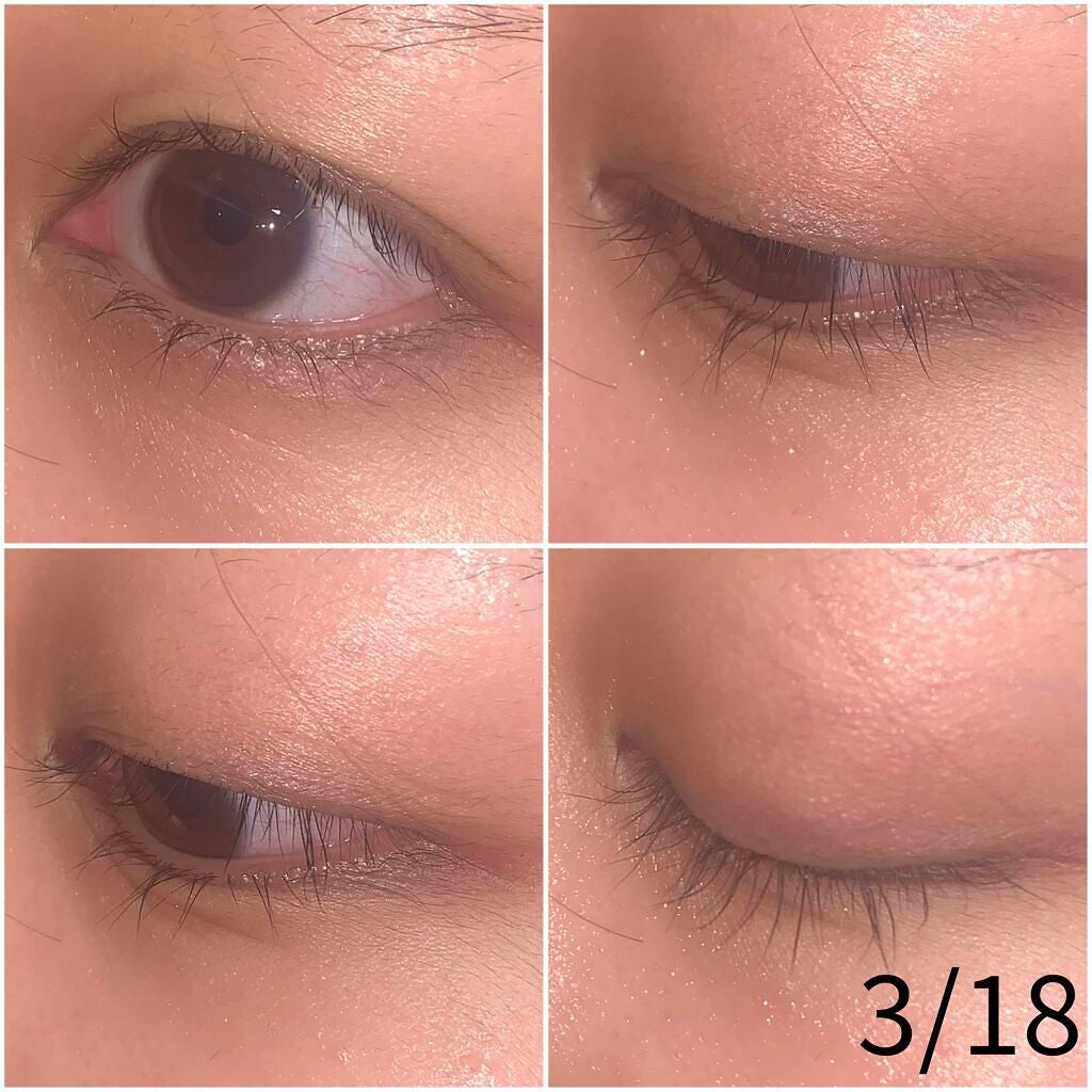 ラッシュアディクト アイラッシュコンディショニングセラム/soaddicted/まつげ美容液を使ったクチコミ(3枚目)