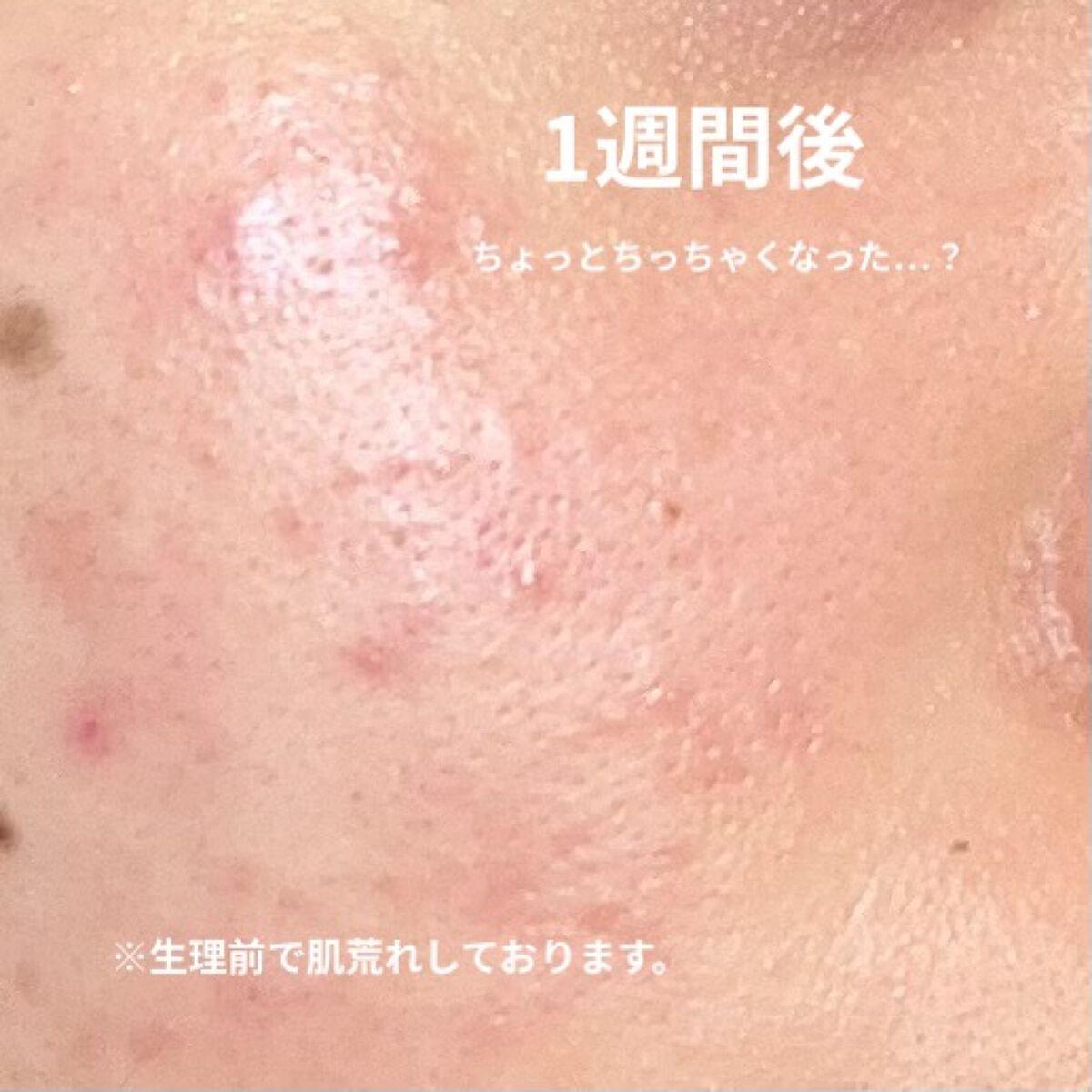 レチノール　シカ　リペア　セラム/innisfree/美容液を使ったクチコミ（3枚目）