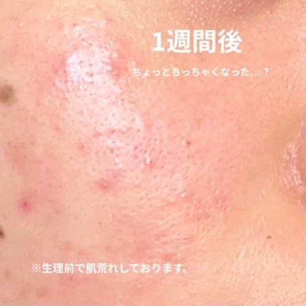 レチノール シカ リペア セラム/innisfree/美容液を使ったクチコミ(3枚目)