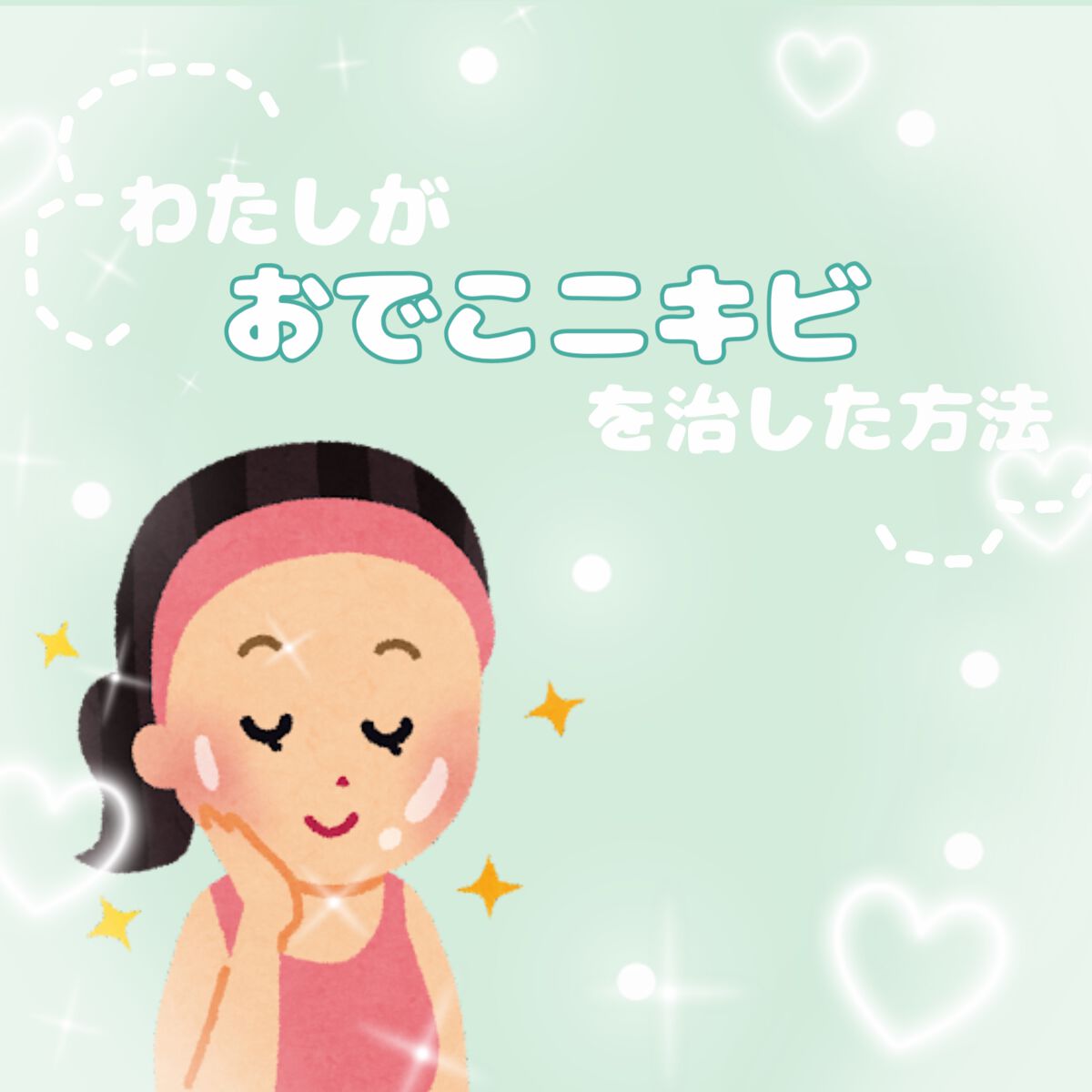 パーフェクトホイップ アクネケア/SENKA(専科)/洗顔フォームを使ったクチコミ(1枚目)