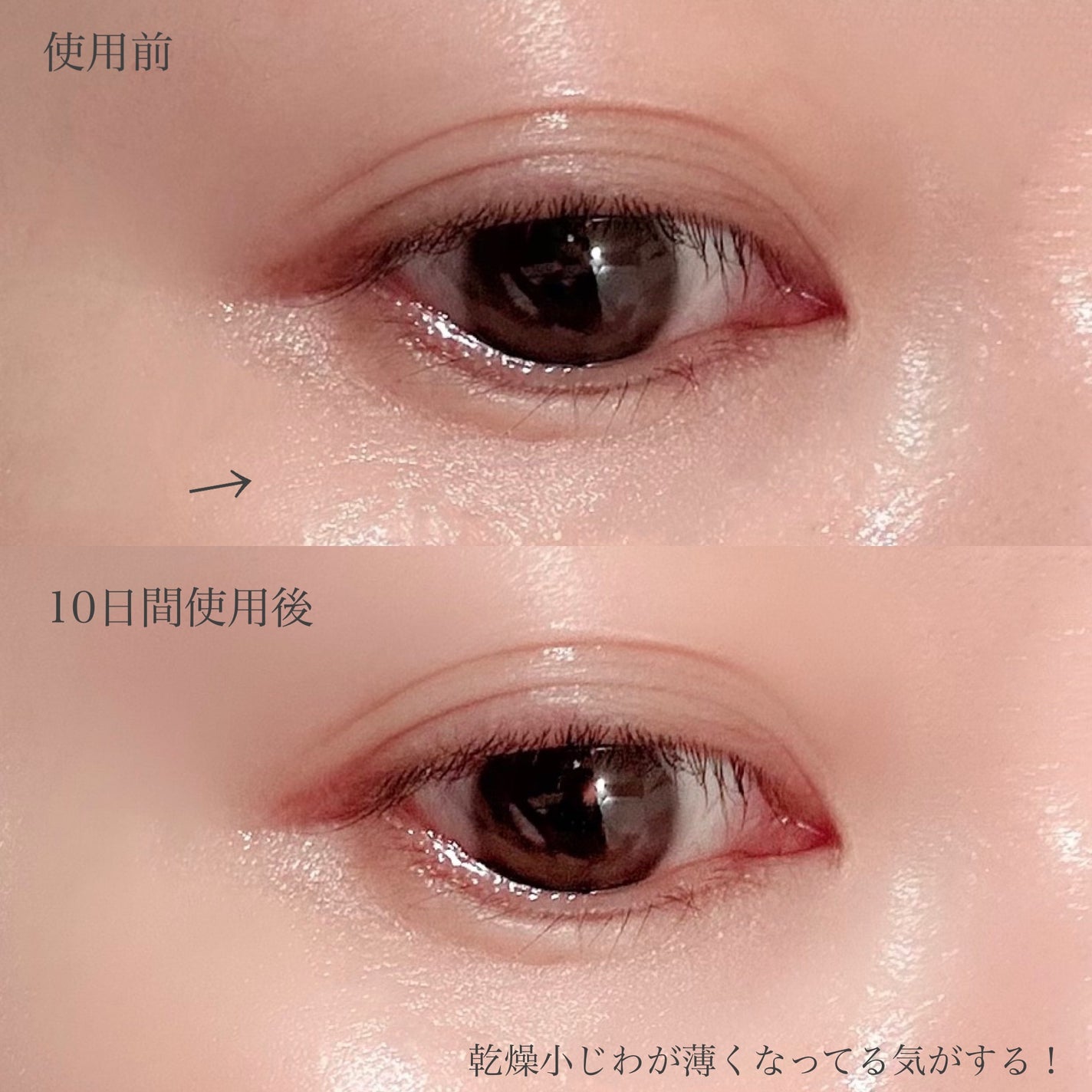 リードルショット リフティングアイクリーム/VT/アイケア・アイクリームを使ったクチコミ(4枚目)