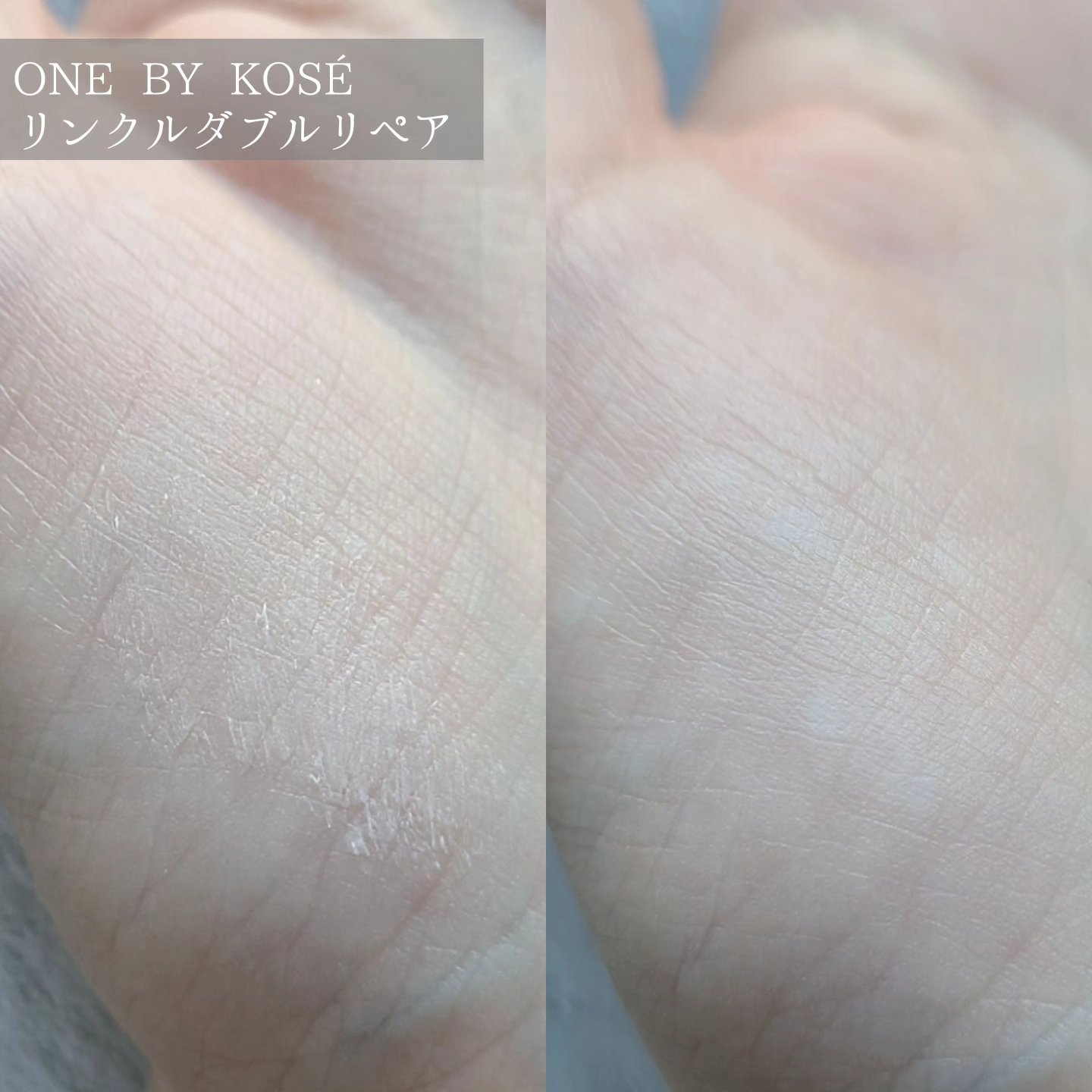 リンクル ダブル リペア/ONE BY KOSE/美容液を使ったクチコミ（3枚目）