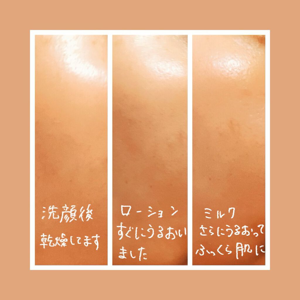 B.A ミルク/B.A/乳液を使ったクチコミ（2枚目）