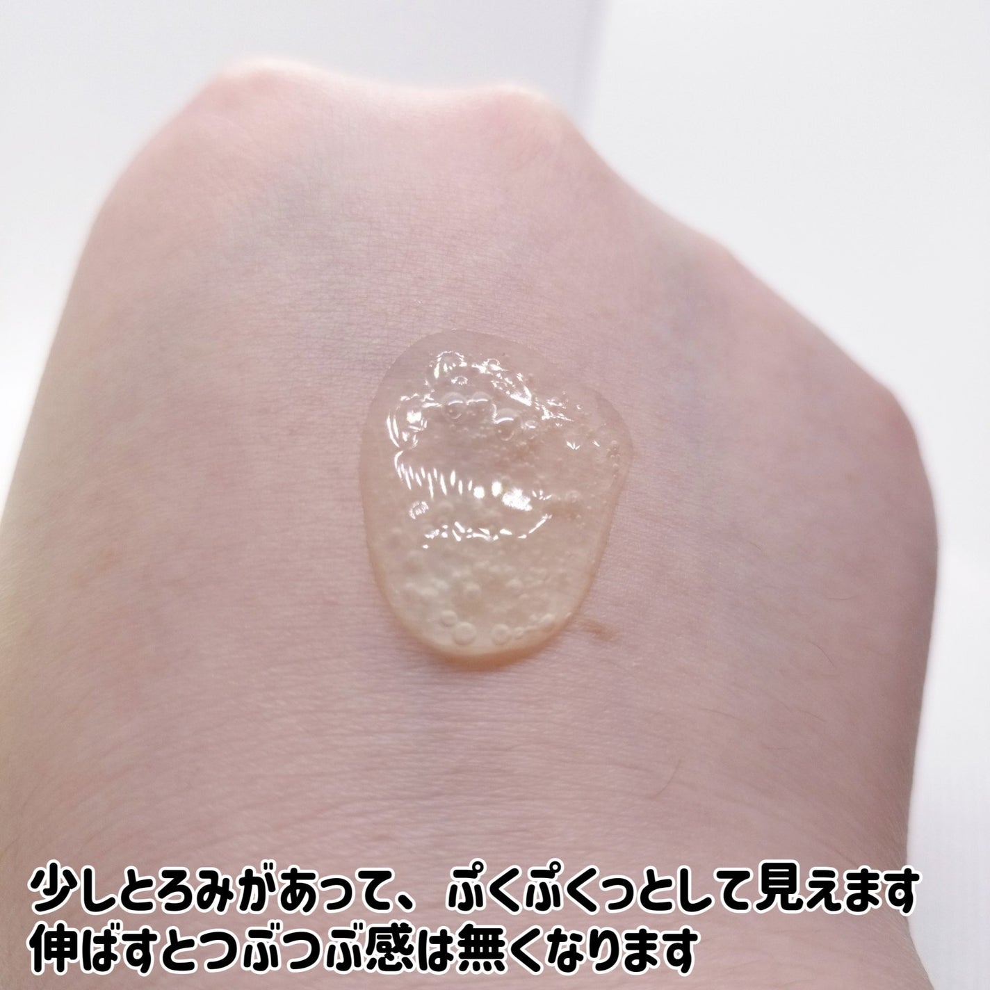 マイクロダーマブースター/XOUL/美容液を使ったクチコミ(6枚目)