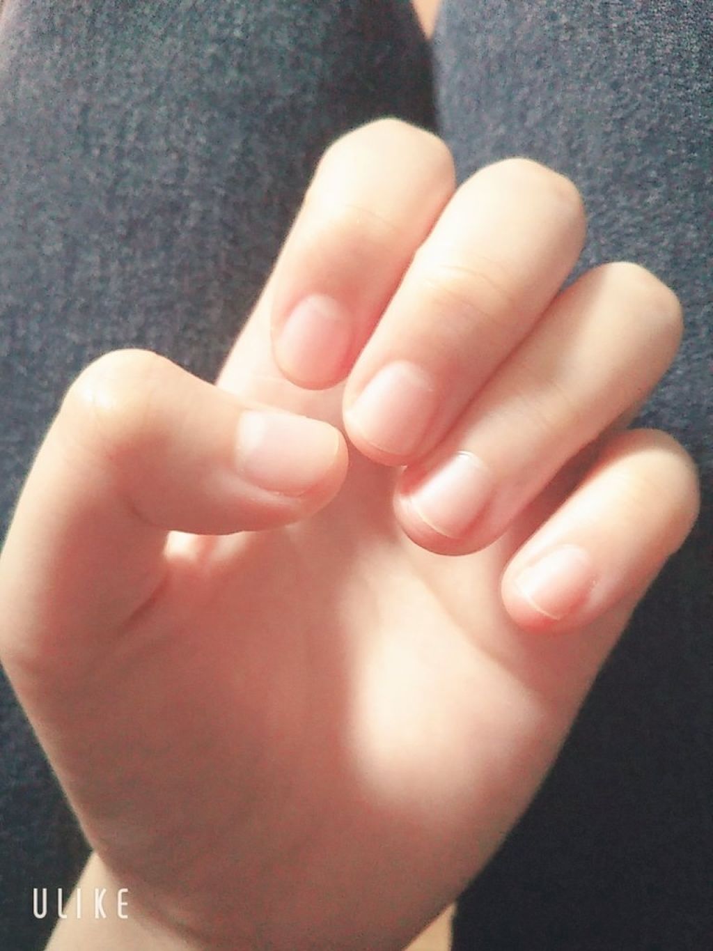 キューティクルオイル/キャンディ ブロッサム/ネイルオイル・トリートメントを使ったクチコミ(1枚目)