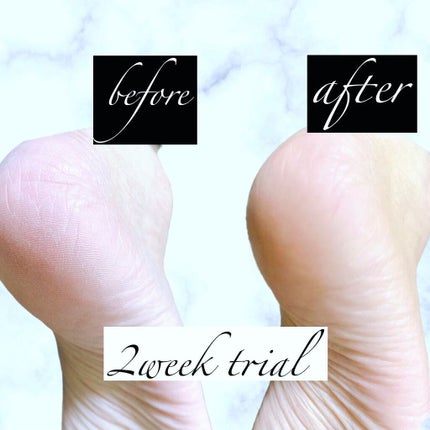 かかとソックス/Pubicare/その他スキンケアグッズを使ったクチコミ(5枚目)