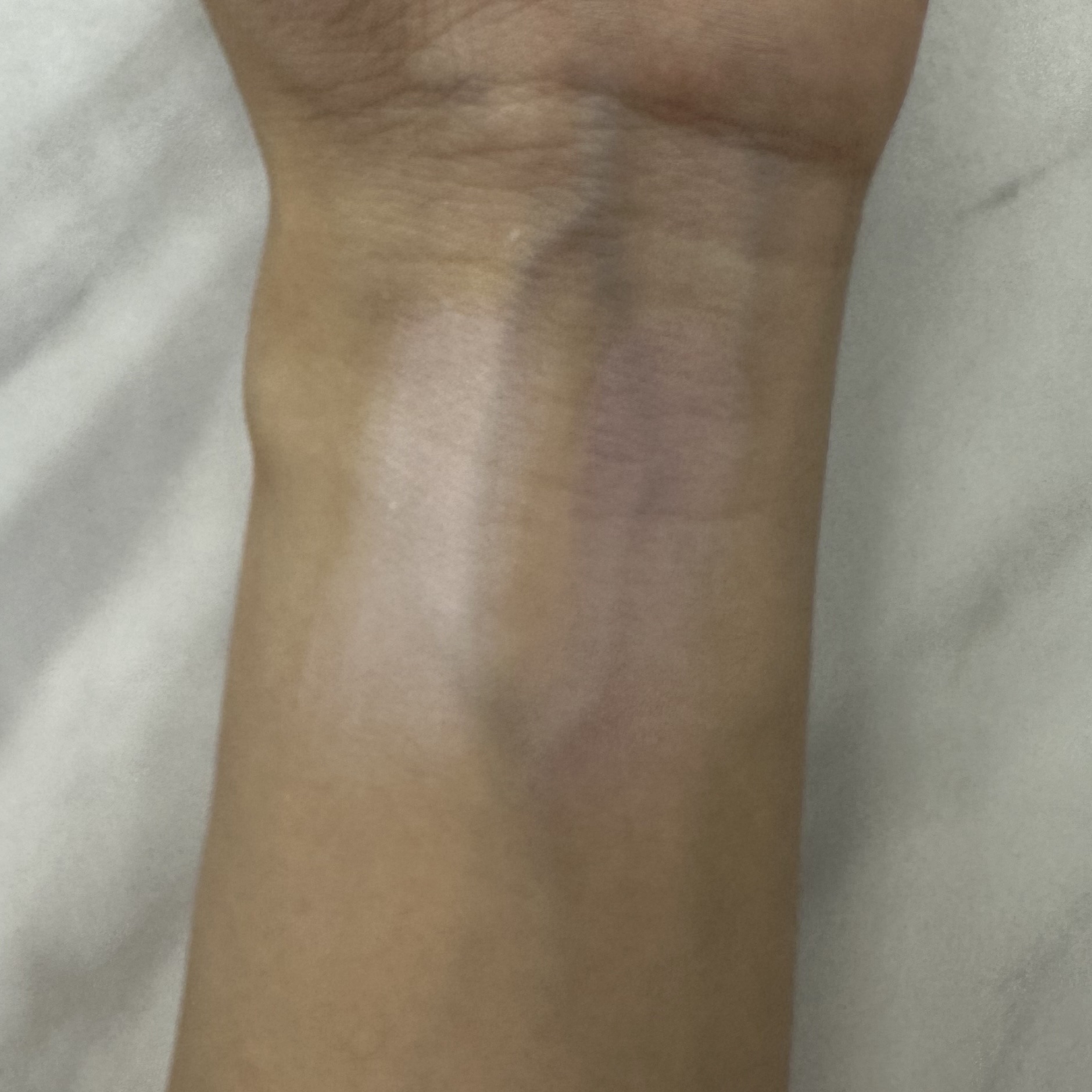 デュアルチーク/2aN/パウダーチークを使ったクチコミ（3枚目）