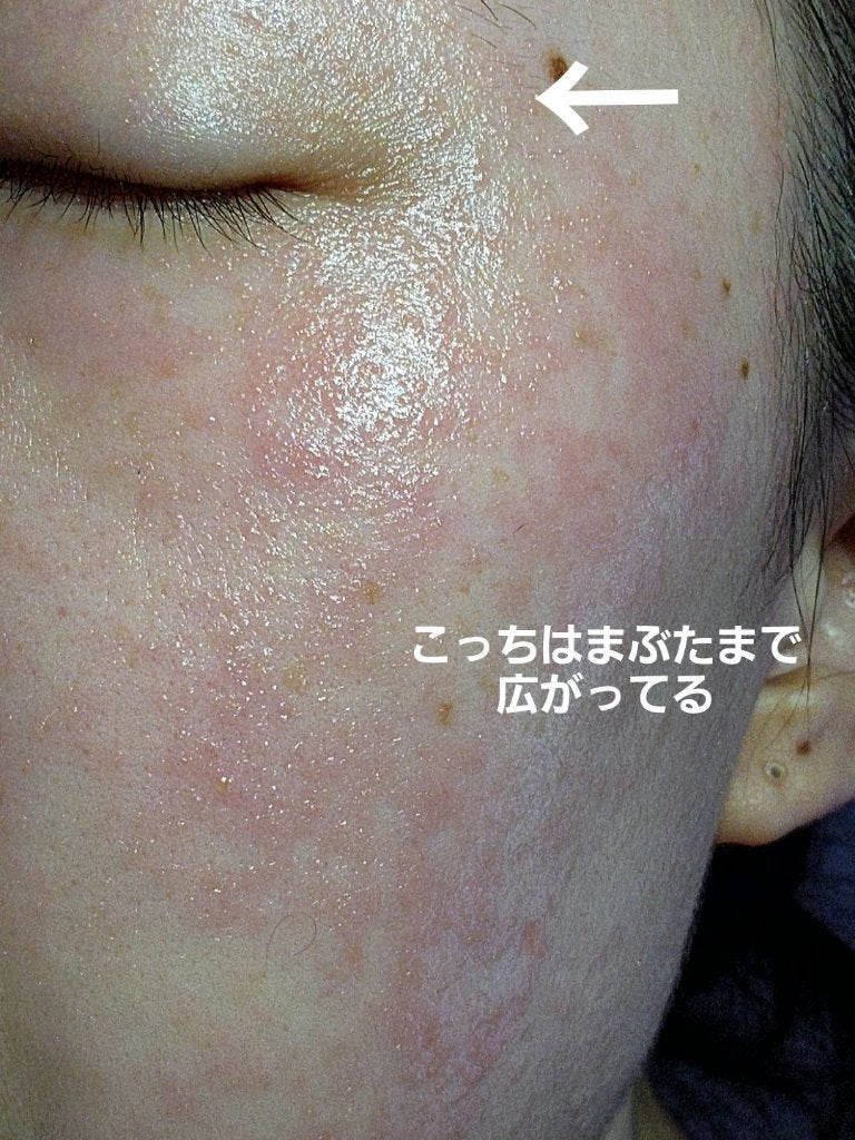 グルタ ビタミンC トーニング アンプル/IOPE/美容液を使ったクチコミ(4枚目)