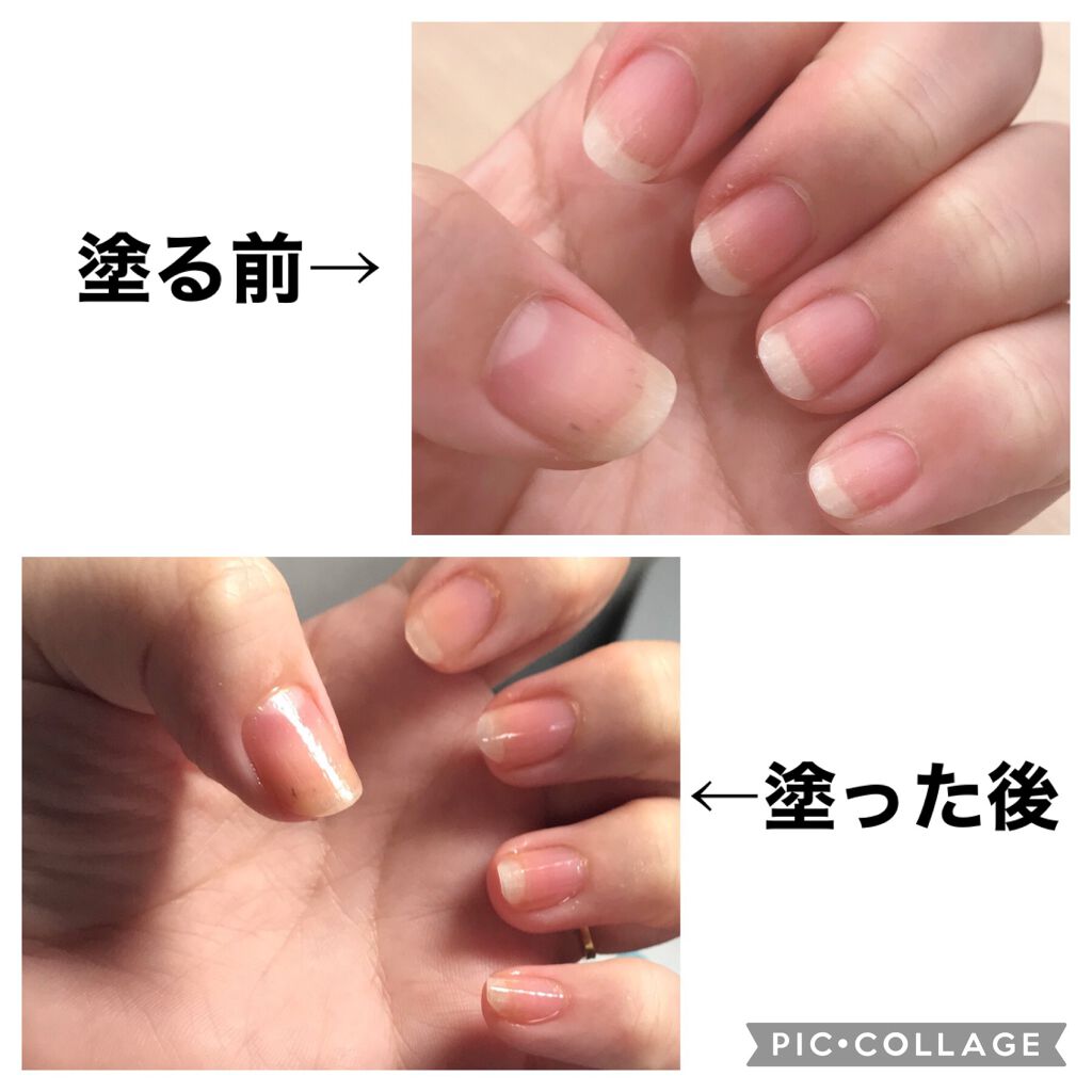 キューティクルオイル/ネイルホリック/ネイルオイル・トリートメントを使ったクチコミ（2枚目）