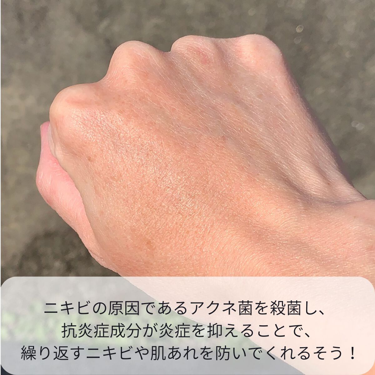 オードムーゲ 薬用ローション(ふきとり化粧水)/オードムーゲ/拭き取り化粧水を使ったクチコミ(6枚目)