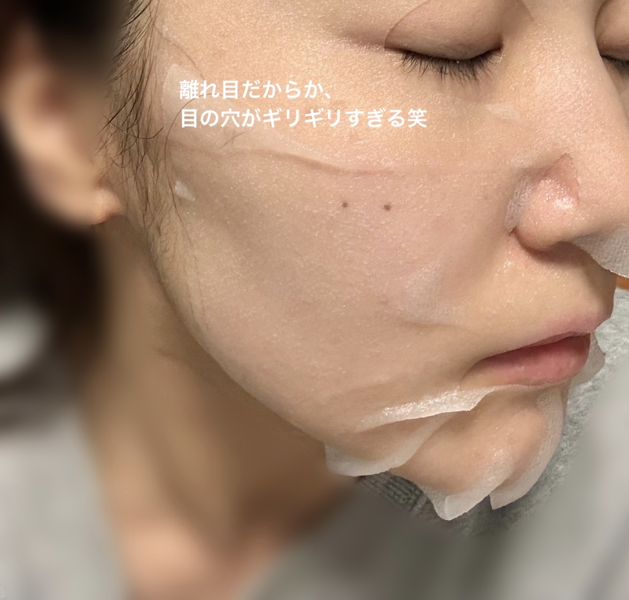 ダーマレーザー スーパーNMN100マスク/クオリティファースト/シートマスク・パックを使ったクチコミ（2枚目）