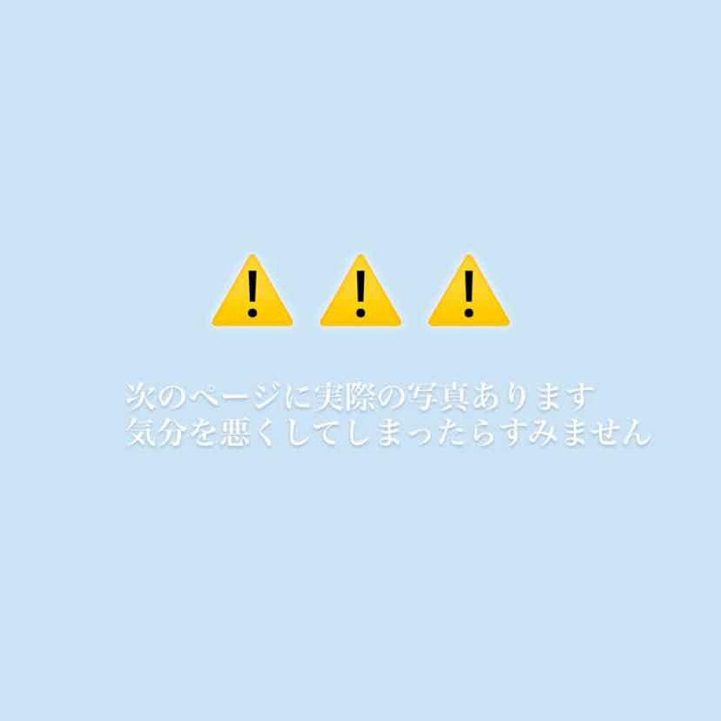 ミュゼホワイトニング 速攻美白 ポリリンキューブ 3個入り/ミュゼホワイトニング/歯磨き粉を使ったクチコミ（2枚目）