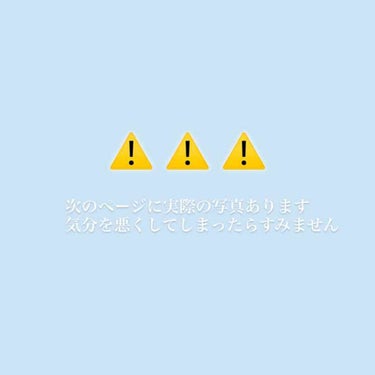 ミュゼホワイトニング 速攻美白 ポリリンキューブ 3個入り/ミュゼホワイトニング/歯磨き粉を使ったクチコミ（2枚目）