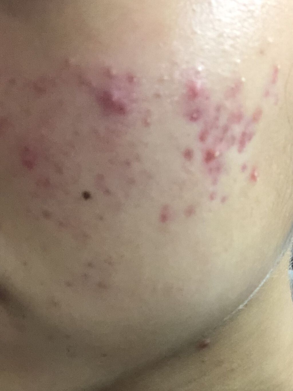 化粧水・敏感肌用・高保湿タイプ/無印良品/化粧水を使ったクチコミ（1枚目）