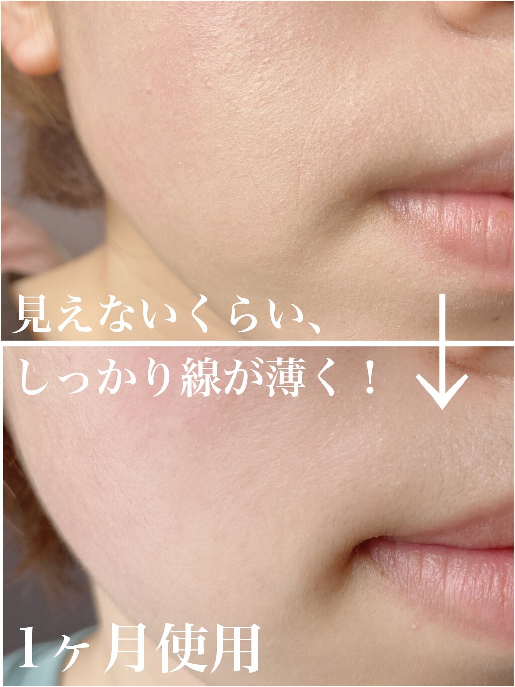 プラセホワイター 薬用美白アイクリーム/明色/アイケア・アイクリームを使ったクチコミ（3枚目）