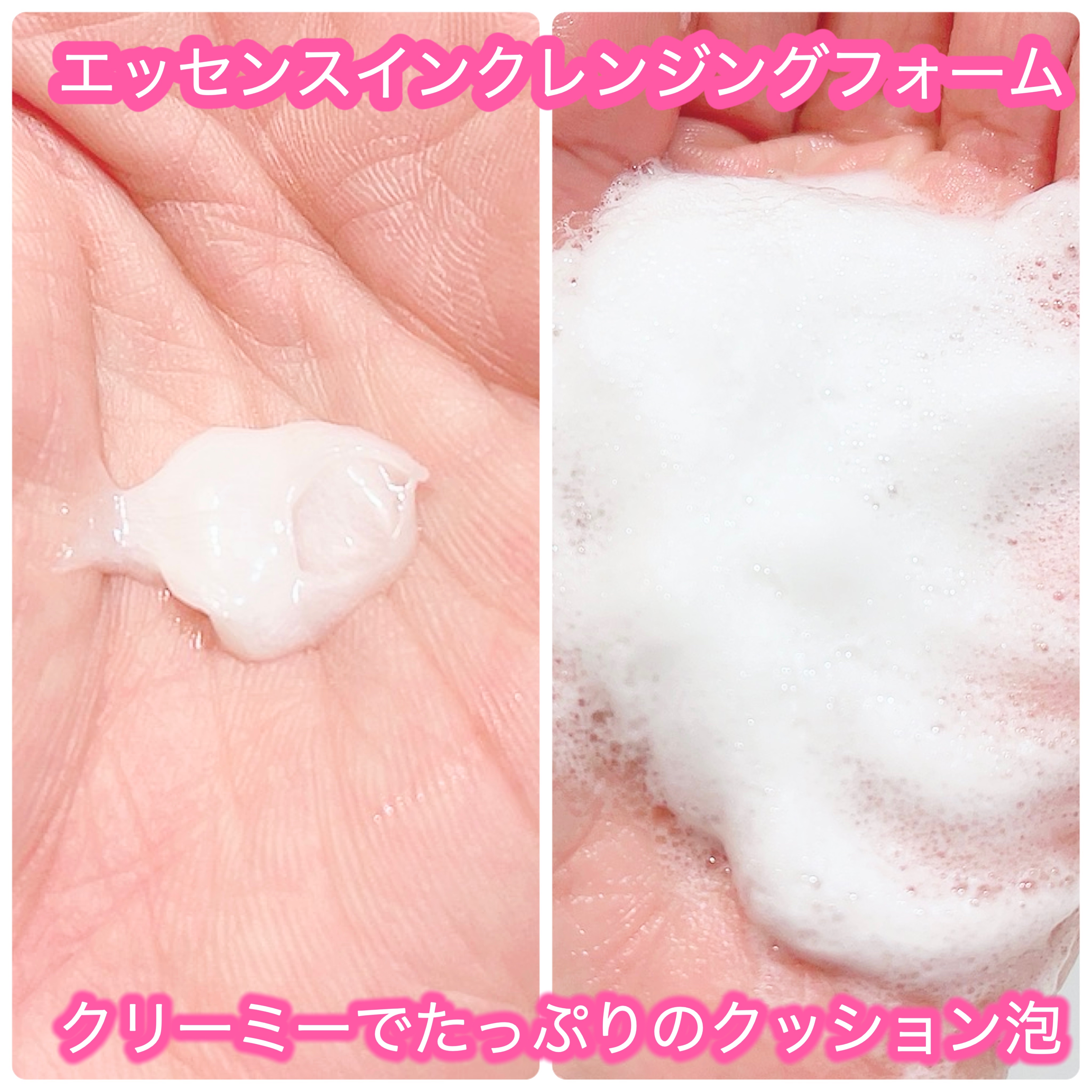 薬用 アクネケア美容液/d プログラム/美容液を使ったクチコミ（2枚目）