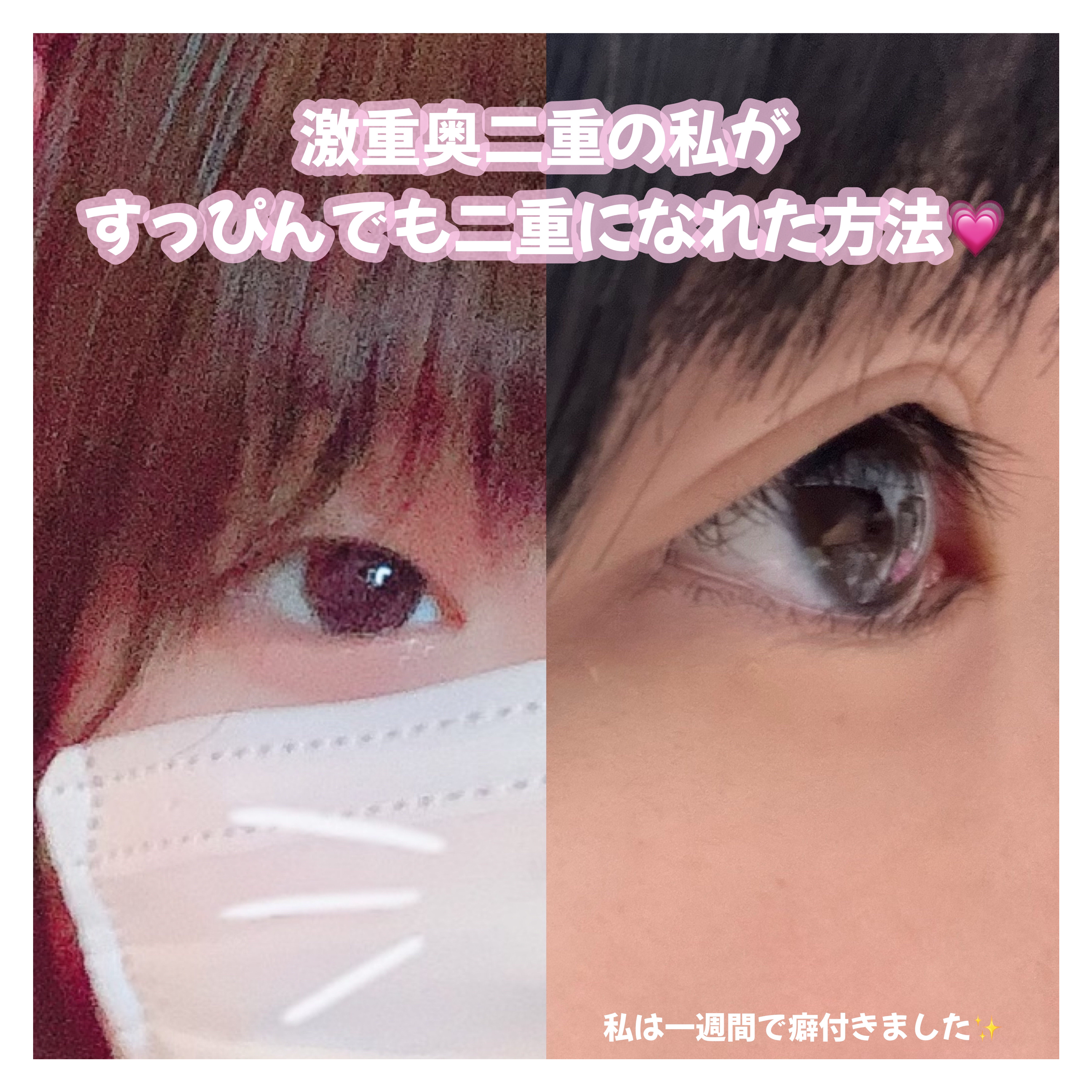 ルドゥーブル プレミアム 通常版 2ml/ルドゥーブル/二重まぶた用アイテムを使ったクチコミ（1枚目）