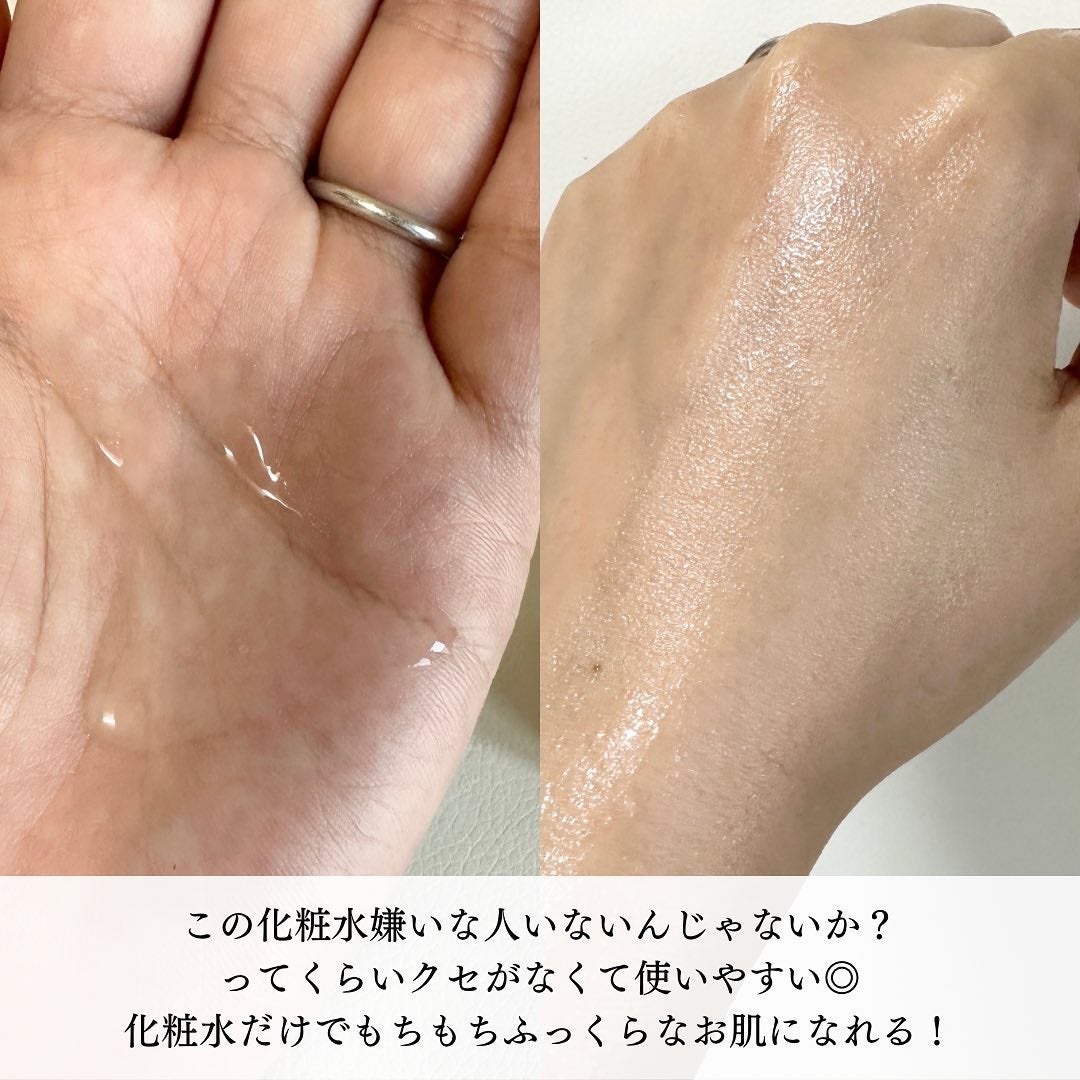 エスト ザ ローション/est/化粧水を使ったクチコミ(3枚目)