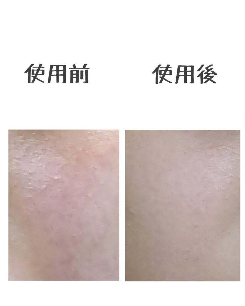 フィットミー コンシーラー/MAYBELLINE NEW YORK/リキッドコンシーラーを使ったクチコミ（3枚目）