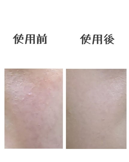 フィットミー コンシーラー/MAYBELLINE NEW YORK/リキッドコンシーラーを使ったクチコミ(3枚目)