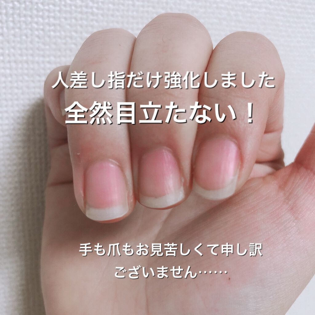 AT トップ&ベースコート/Art Collection/ネイルトップコートを使ったクチコミ(3枚目)