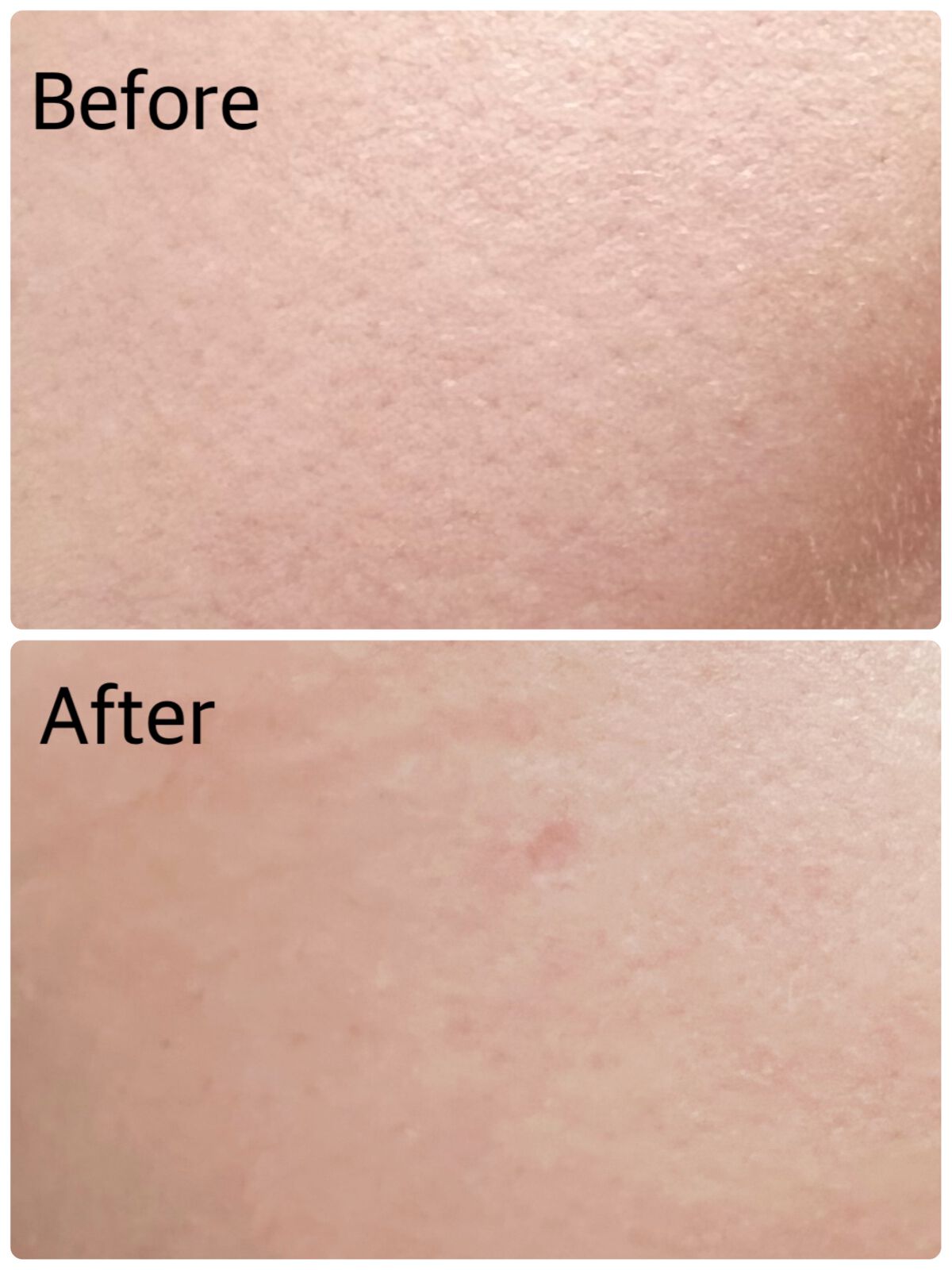 ルルルンプレシャス GREEN(バランス)【旧】/ルルルン/シートマスク・パックを使ったクチコミ（2枚目）