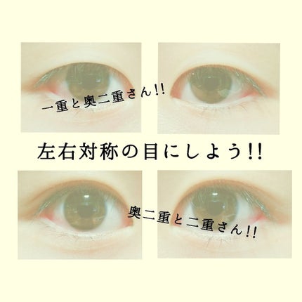 アイビューティー フィクサー WP/アストレア ヴィルゴ/二重まぶた用アイテムを使ったクチコミ(1枚目)