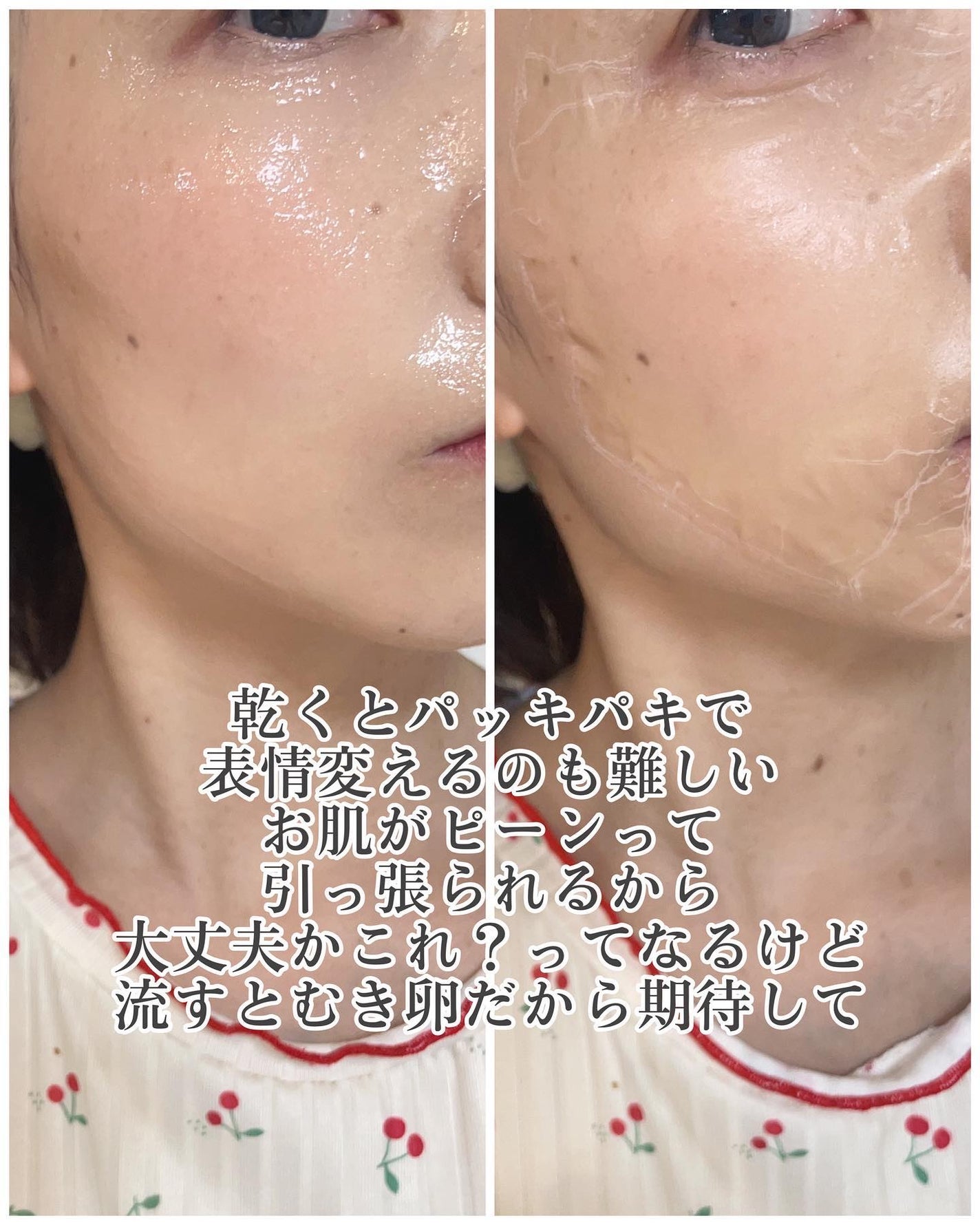 センテラ アンプル/SKIN1004/美容液を使ったクチコミ(6枚目)