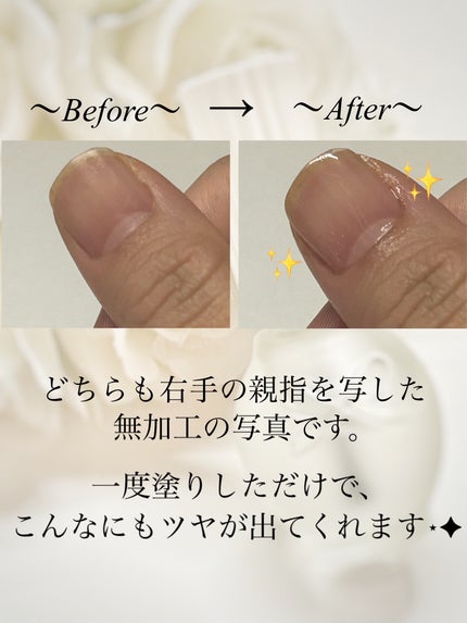 デュアルネイルセラム/シュガードール/ネイルオイル・トリートメントを使ったクチコミ(2枚目)