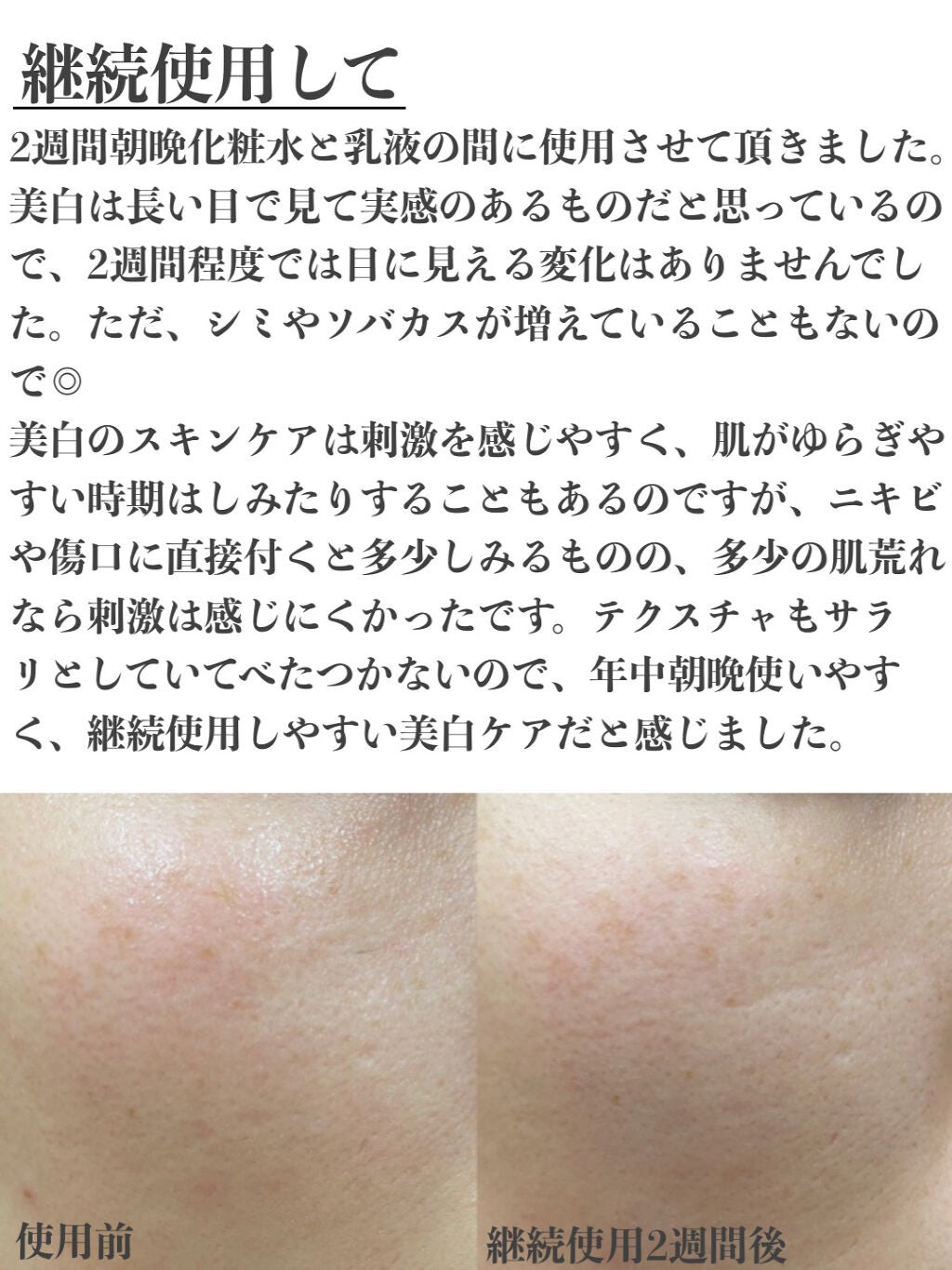 メラノショット ホワイト D/ONE BY KOSE/美容液を使ったクチコミ(4枚目)