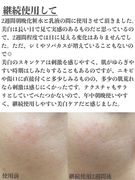 メラノショット ホワイト D/ONE BY KOSE/美容液を使ったクチコミ(4枚目)