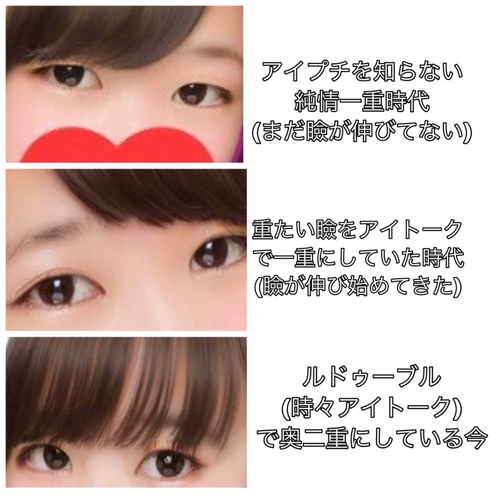 アイトーク ルドゥーブルの二重まぶた用アイテムを使った口コミ 一重女子 二重だけが正義だと思ってませんか By ゆうか アトピー肌 10代後半 Lips アイトーク ルドゥーブルの二重まぶた用アイテムを使った口コミ 一重女子 二重だけが正義だと思ってませんか By ゆうか アトピー肌 10代後半 Lips