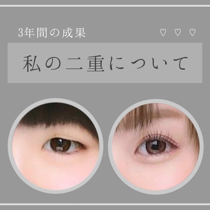 アイトーク/アイトーク/二重まぶた用アイテムを使ったクチコミ(1枚目)
