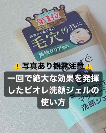 今回は、私が鼻の黒ずみ毛穴に絶大な効果を感じることができた方法をご紹介させていただきます☺️

⚠️まず写真についてですが苦手な方はご視聴をお控えください。
１枚目がbefore・２枚目が after
