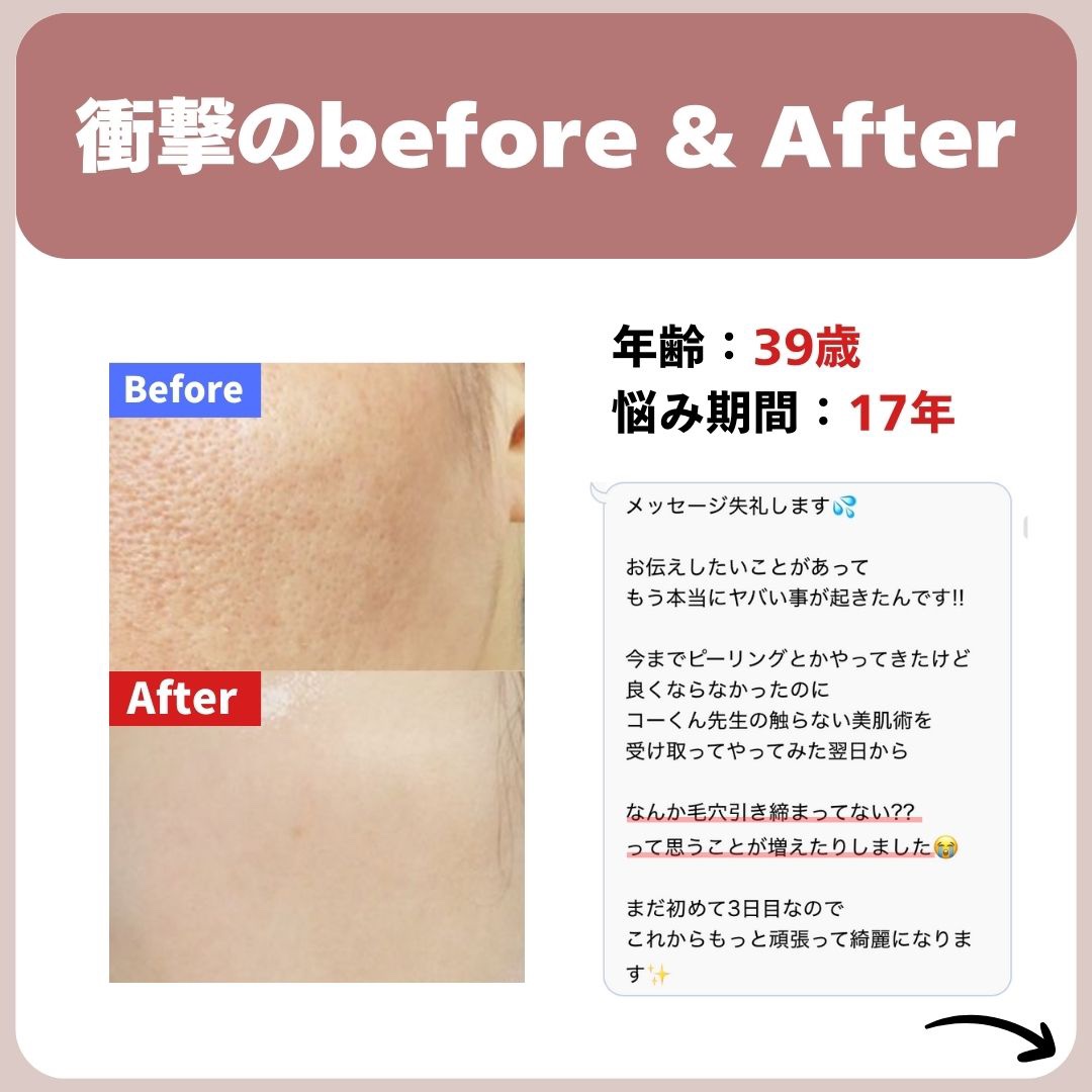 を使ったクチコミ（3枚目）