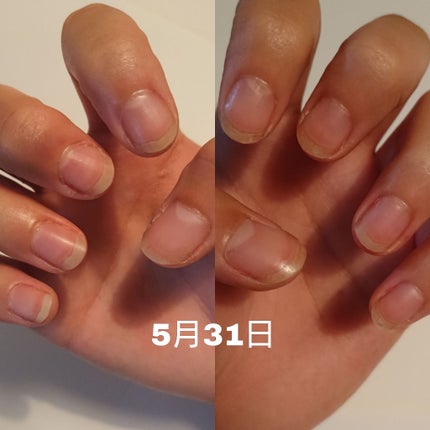 ネイルファンデーション/パラドゥ/マニキュアを使ったクチコミ(2枚目)
