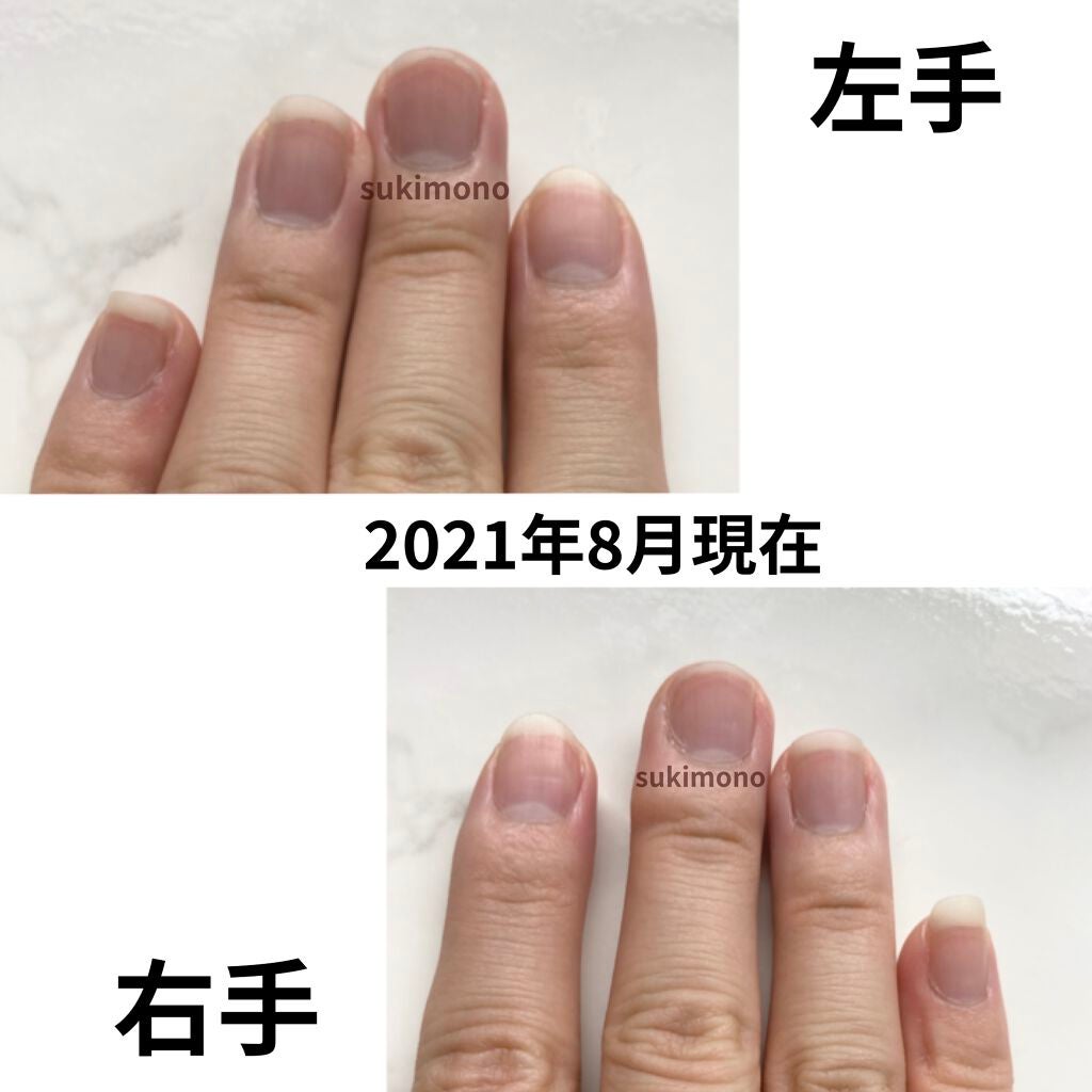 ピュアビューエッセンスHY ヒアルロン酸/ジャパンギャルズ/美容液を使ったクチコミ(2枚目)