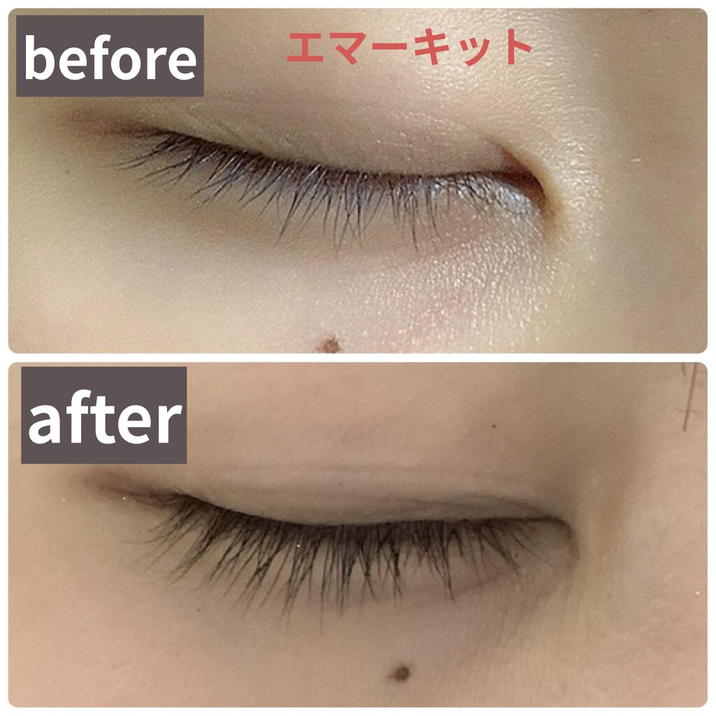 EMAKED（エマーキット）/水橋保寿堂製薬/まつげ美容液を使ったクチコミ（1枚目）