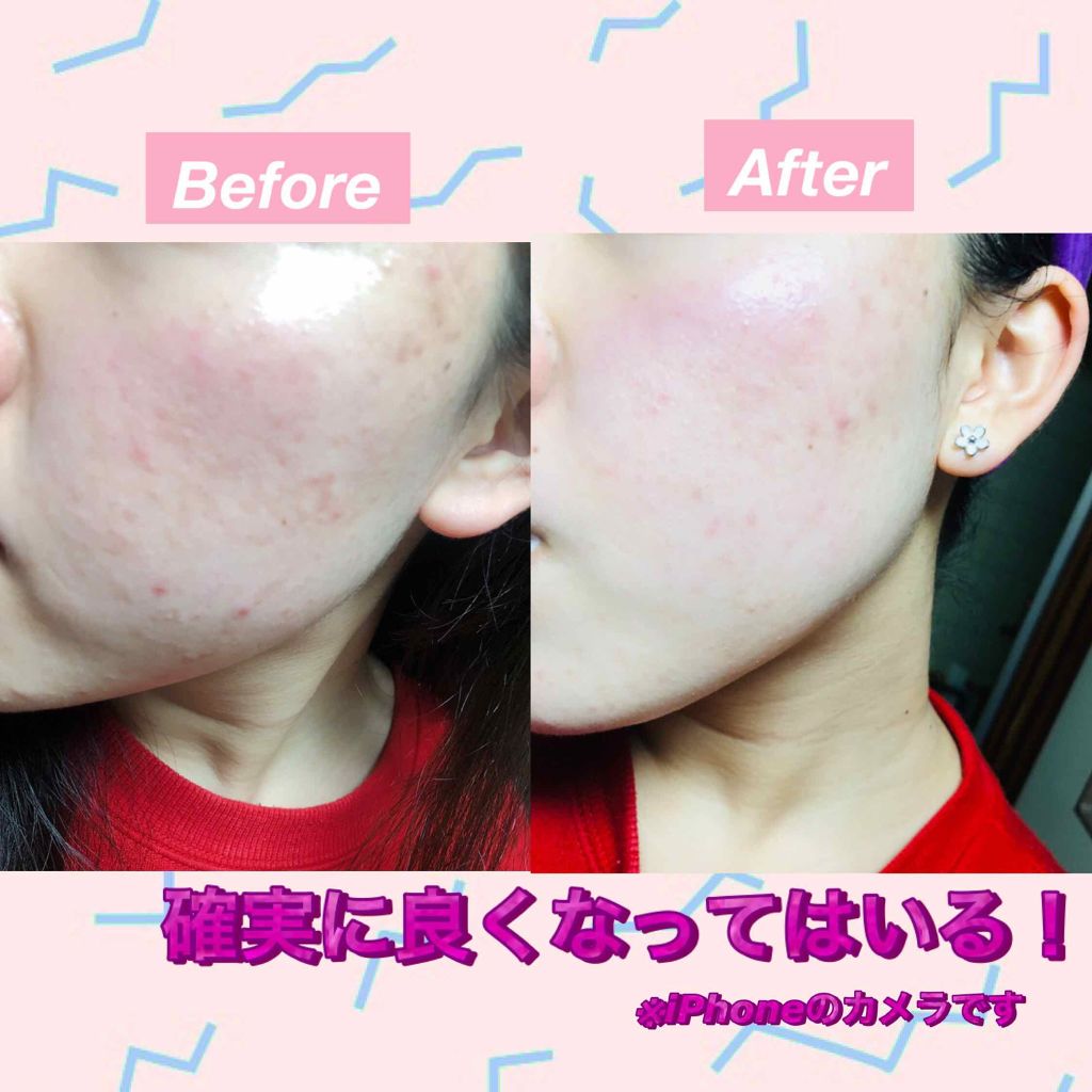 レチノールクリーム/ビタミンワールド/フェイスクリームを使ったクチコミ(3枚目)