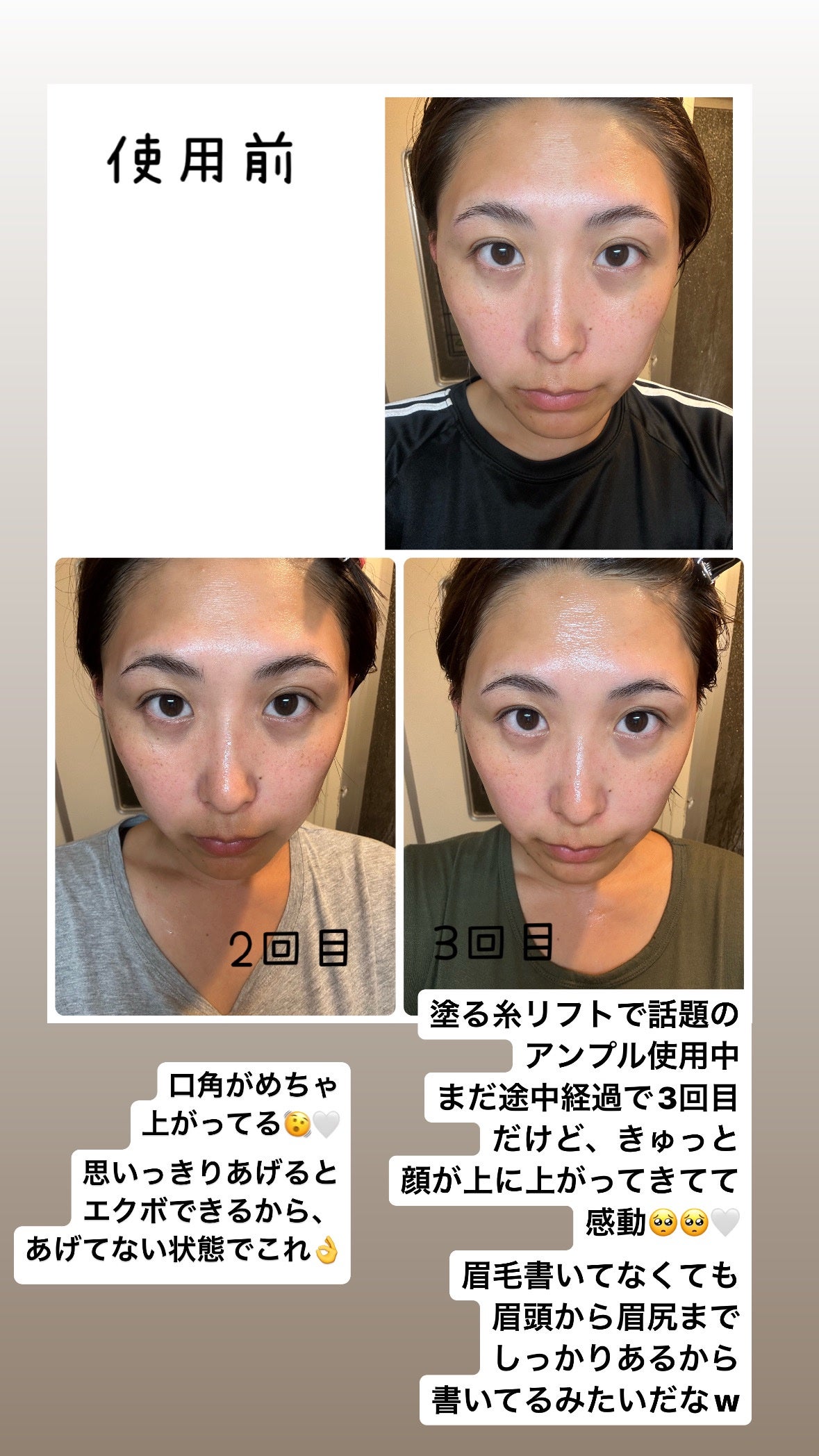 リマージ糸リフティングアンプル/REVENIP/美容液を使ったクチコミ(2枚目)