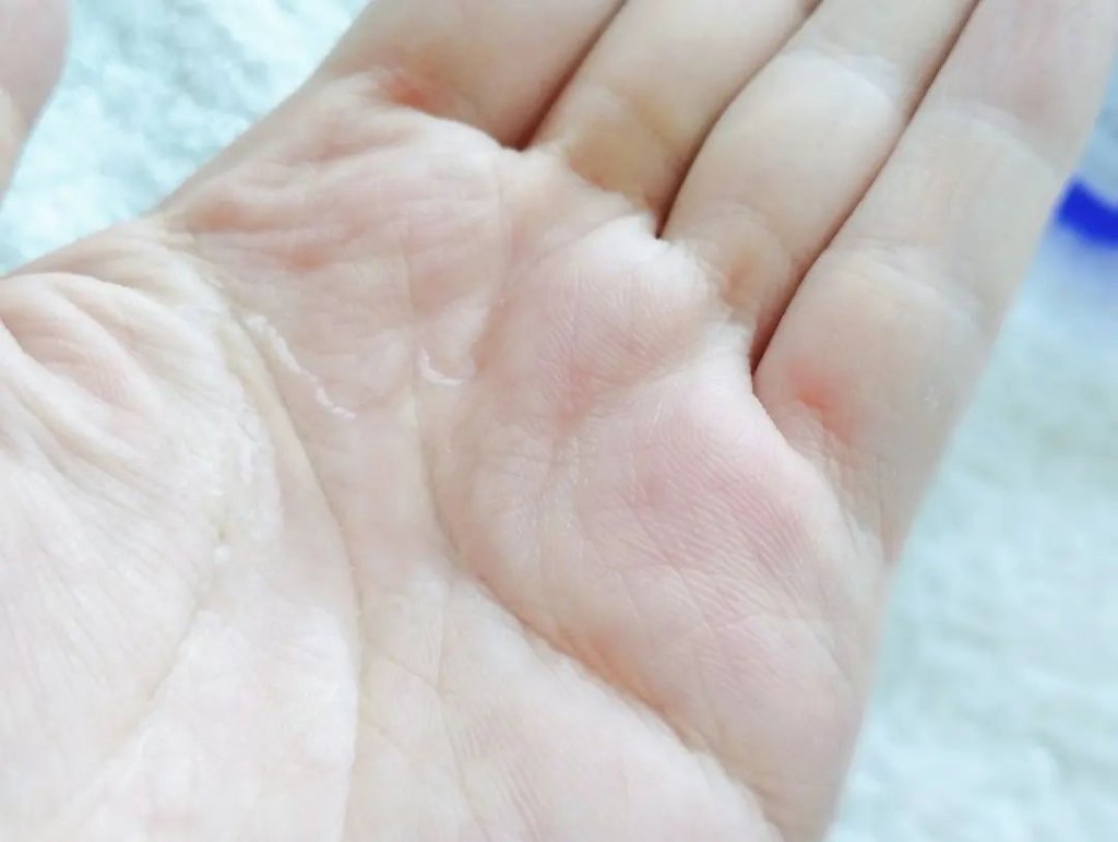 タカミスキンピール/タカミ/ブースター・導入液を使ったクチコミ（3枚目）