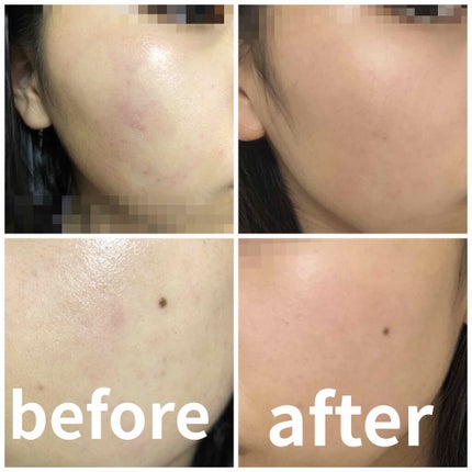 プリスクリードD(医薬品)/IHADA/その他を使ったクチコミ(1枚目)