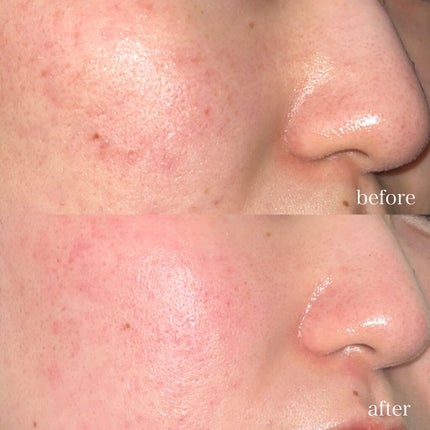 を使ったクチコミ(2枚目)