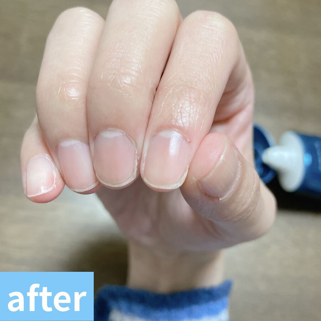 ビューティーチャージ 無香料/アトリックス/ハンドクリームを使ったクチコミ（3枚目）