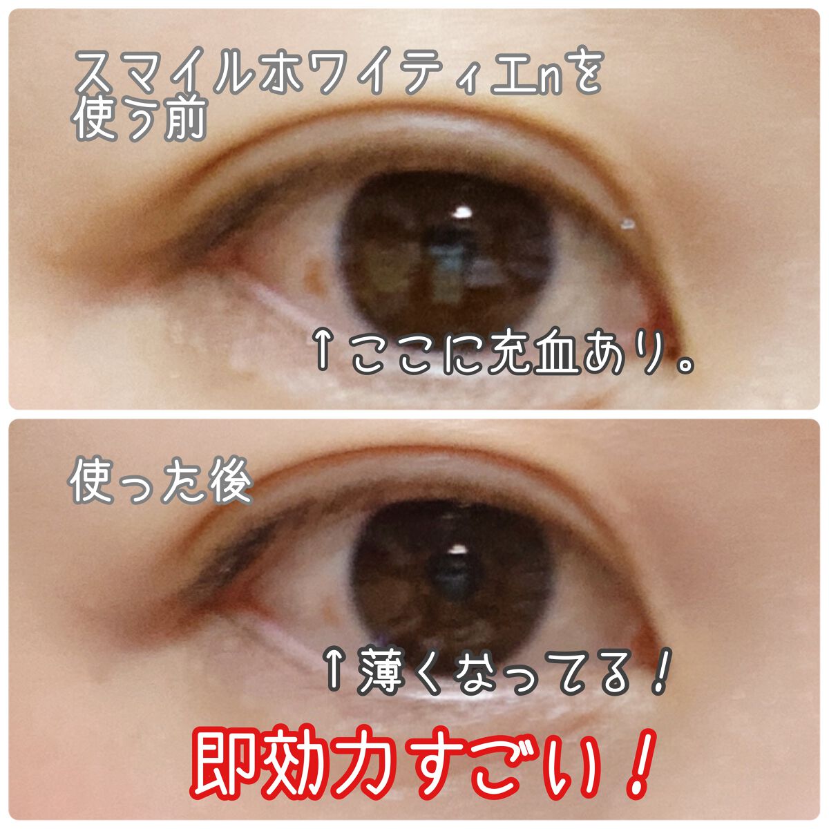 スマイルホワイティエn（医薬品）/ライオン/その他を使ったクチコミ（2枚目）