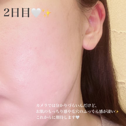 リードルショット300/VT/美容液を使ったクチコミ(4枚目)