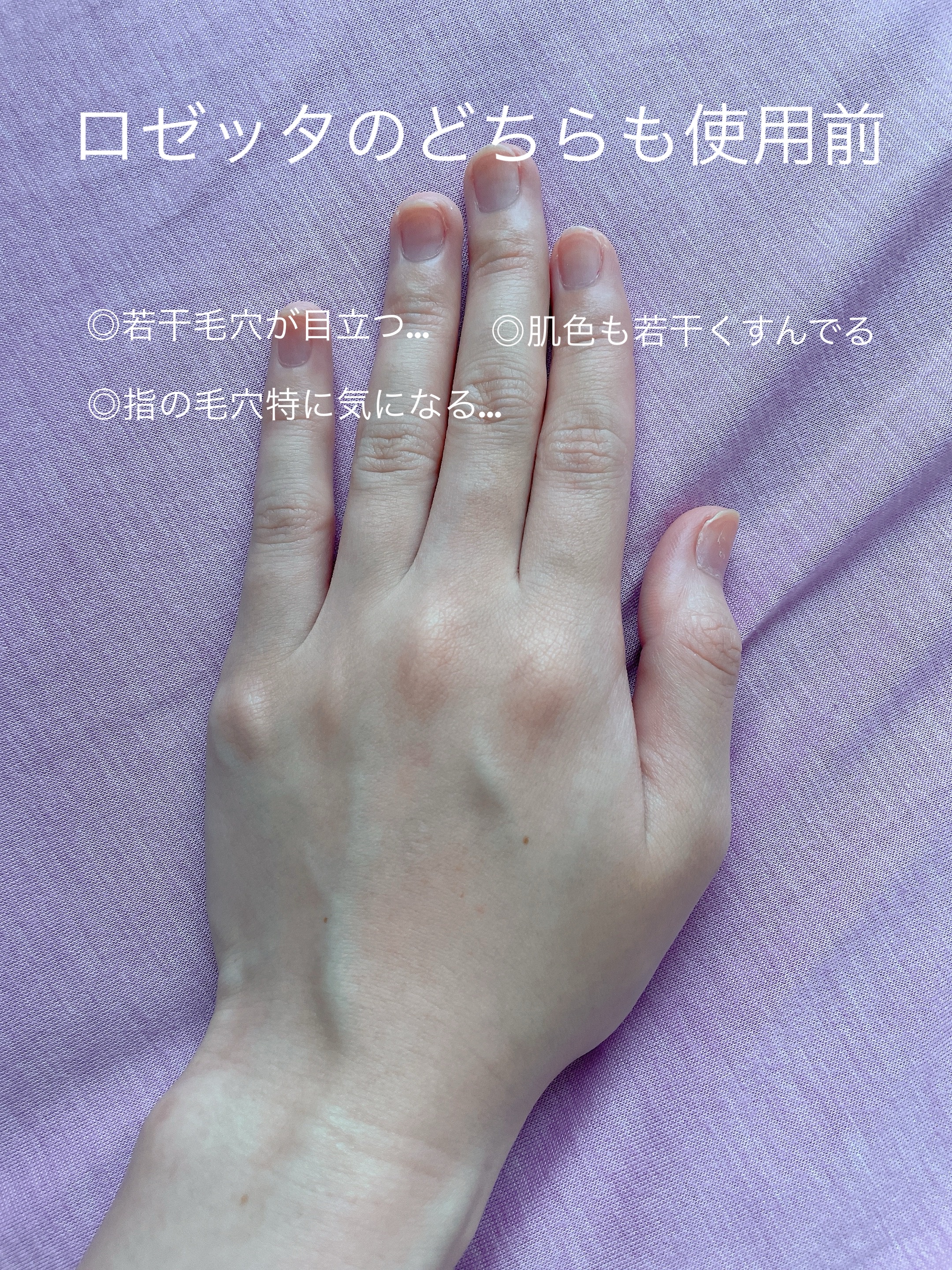 ロゼットゴマージュ クリアピール/ロゼット/スクラブ・ゴマージュを使ったクチコミ（2枚目）